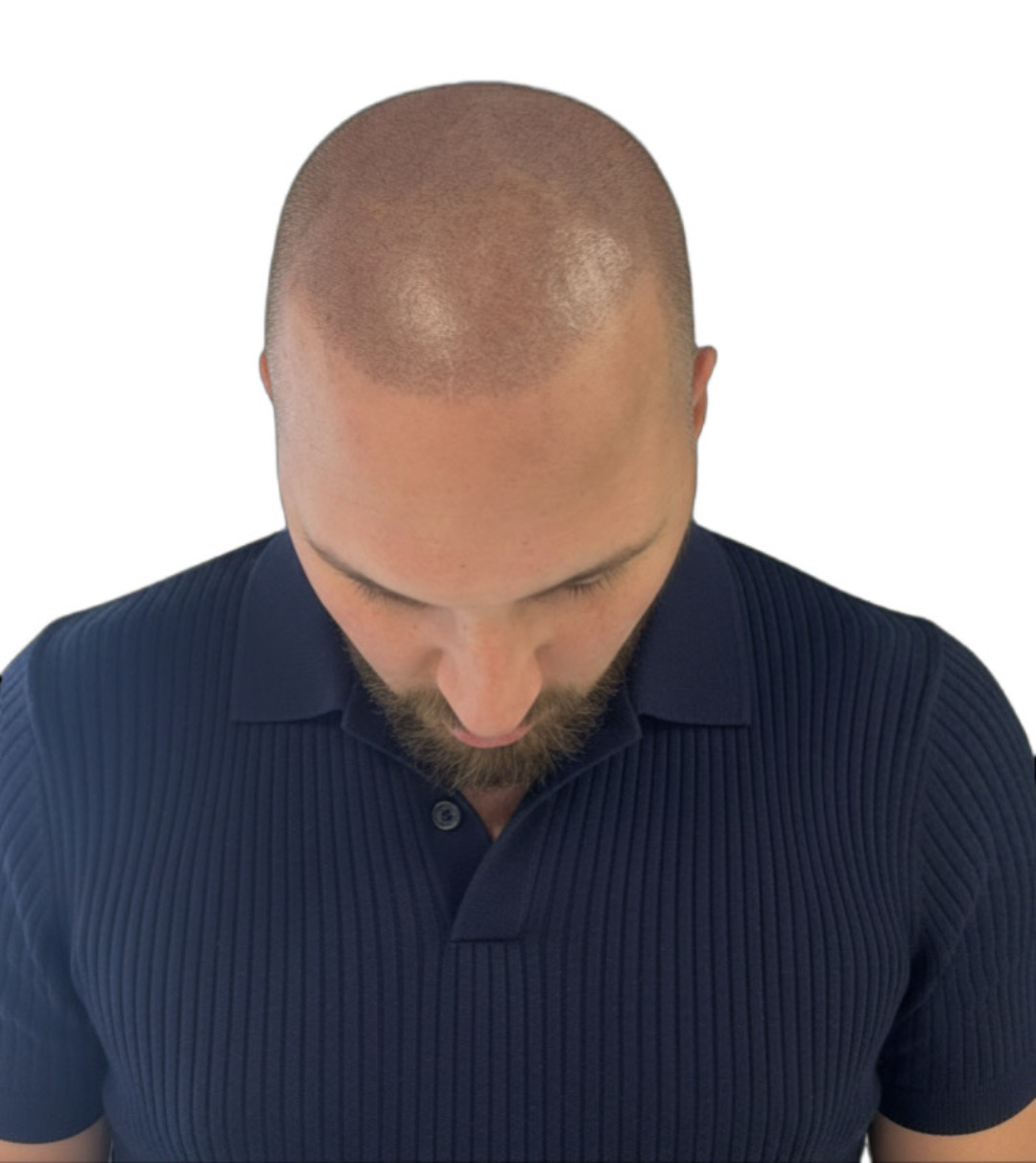 Après micropigmentation
